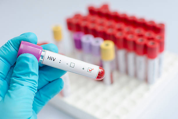unas-70-mil-personas-viven-con-vih-en-la-republica-dominicana