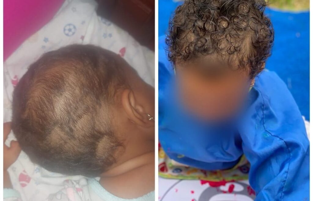 hombre-denuncia-que-hija-de-11-meses-es-victima-de-maltrato-en-su-colegio