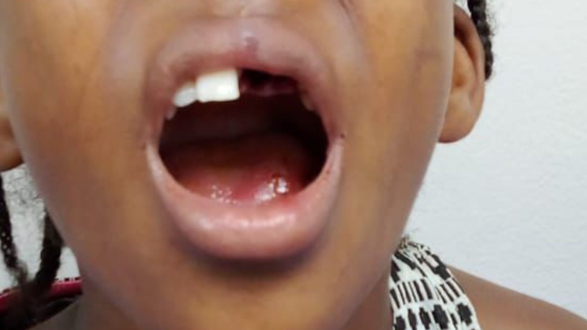 ¡a-golpes!-hombre-le-tumba-dientes-a-su-hija-de-9-anos