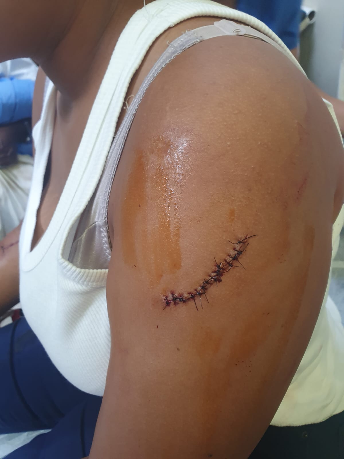 padre-de-menor-que-recibio-varias-estocadas-pide-que-las-agresoras-sean-apresadas