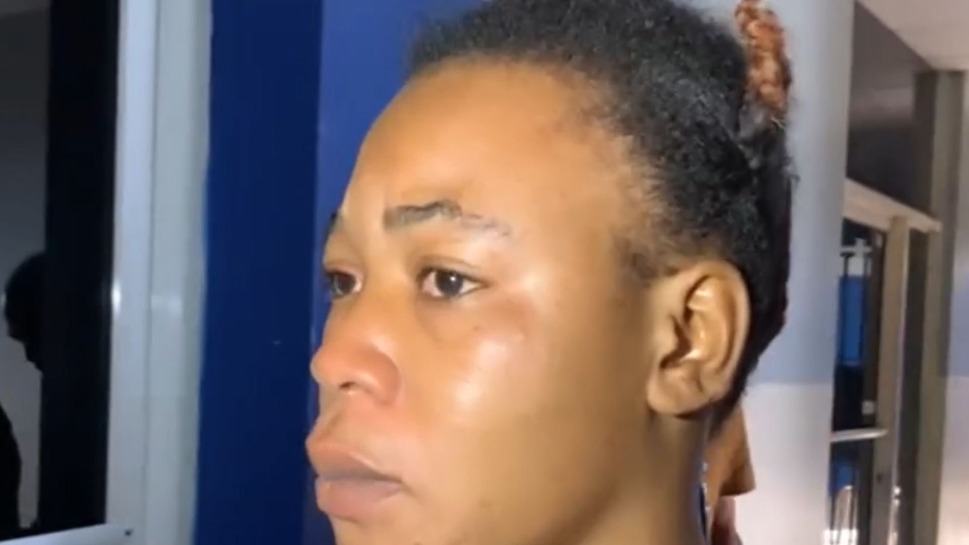 detienen-a-mujer-acusada-de-quemar-con-agua-caliente-a-su-hija-menor-de-edad