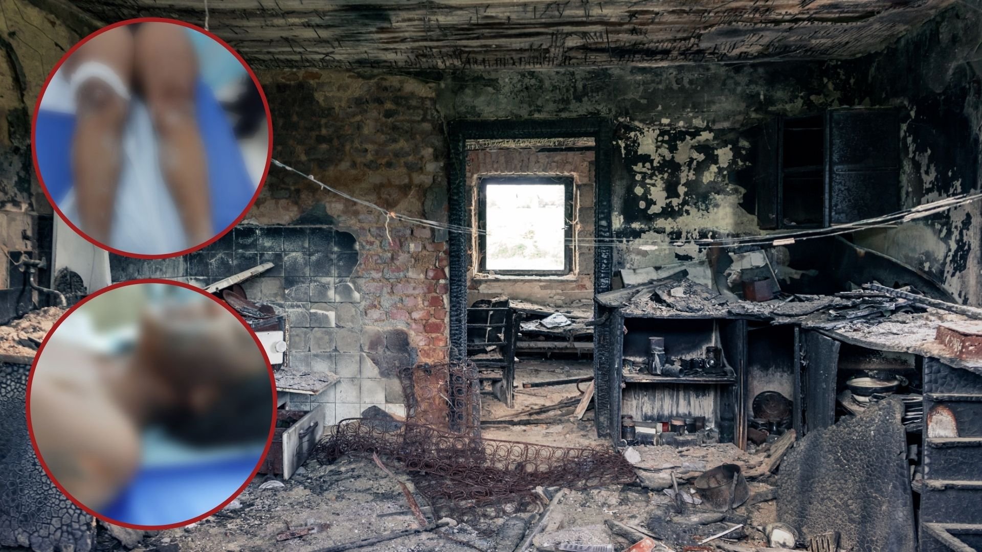 nina-muere-tras-incendiarse-su-vivienda;-madre-trato-de-salvarla,-pero-no-pudo