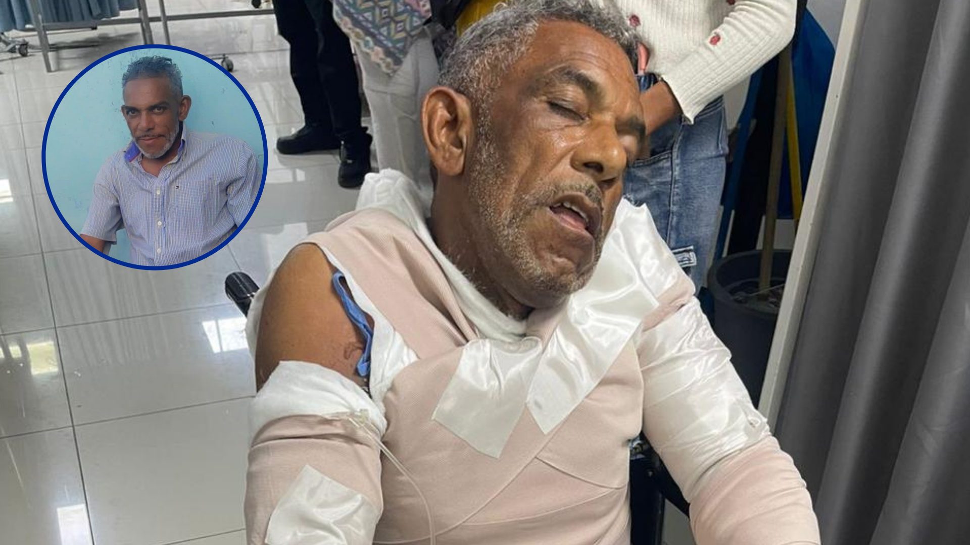 muere-hombre-que-pareja-quemo-partes-intimas-en-higuey