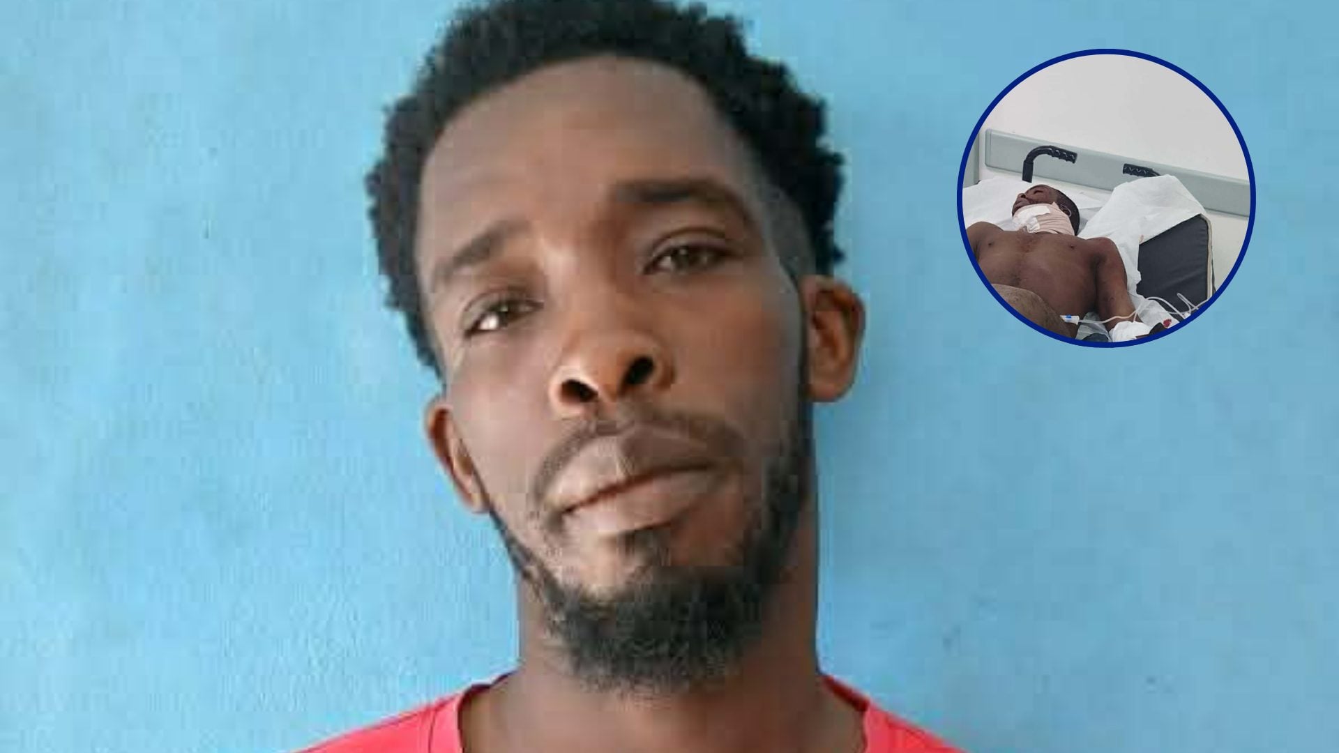 haitiano-recibe-corte-en-el-cuello-con-arma-blanca-tras-pelea-con-su-hermano