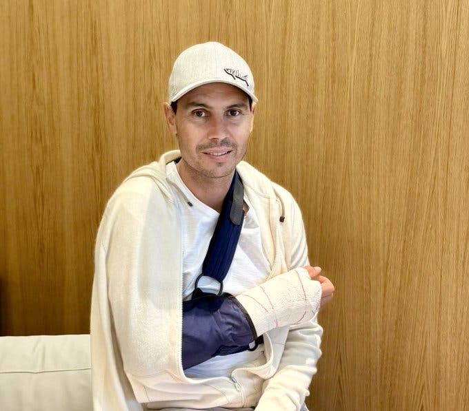 rafa-nadal-se-somete-a-cirugia-en-la-mano-por-artrosis-severa:-¿como-afecta-su-carrera?