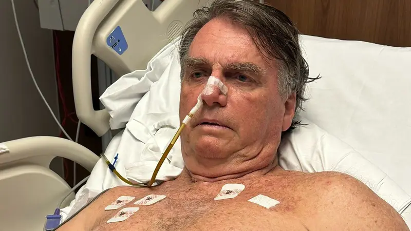 expresidente-bolsonaro-entra-al-quirofano-por-persistente-hipo