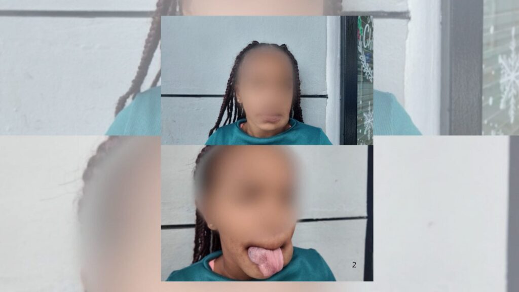 madre-solicita-ayuda-para-cirugia-de-su-hija-tras-negativa-de-cobertura-de-senasa