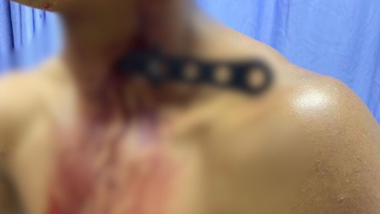 video:-intento-de-asalto-deja-a-uno-de-los-ladrones-herido-en-el-cuello