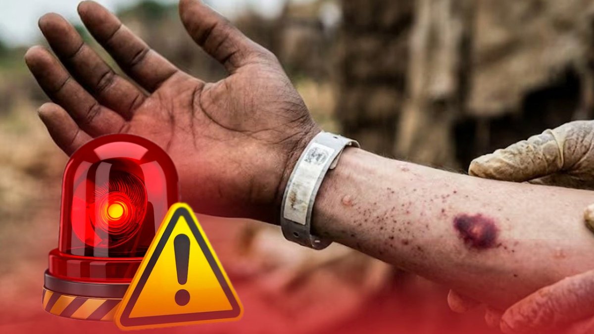 ¡alerta-preventiva-por-ebola!-ministerio-de-salud-fortalece-vigilancia