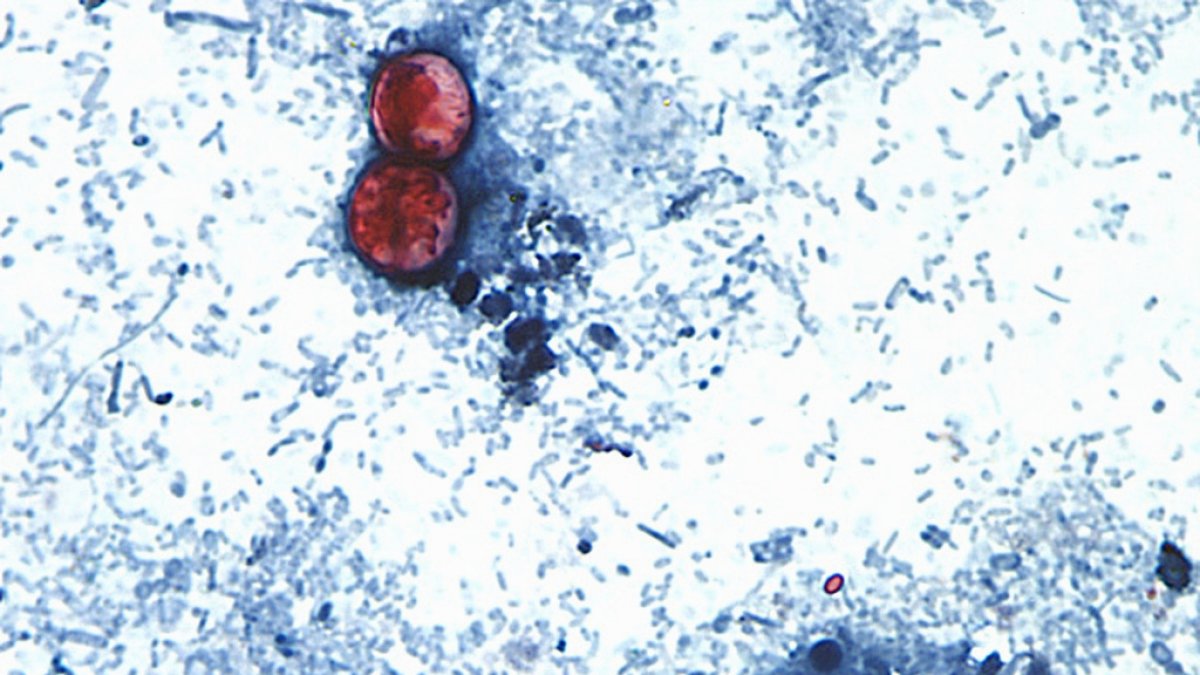 eeuu.-investiga-brote-de-parasito-intestinal-que-provoca-diarrea-en-varios-estados
