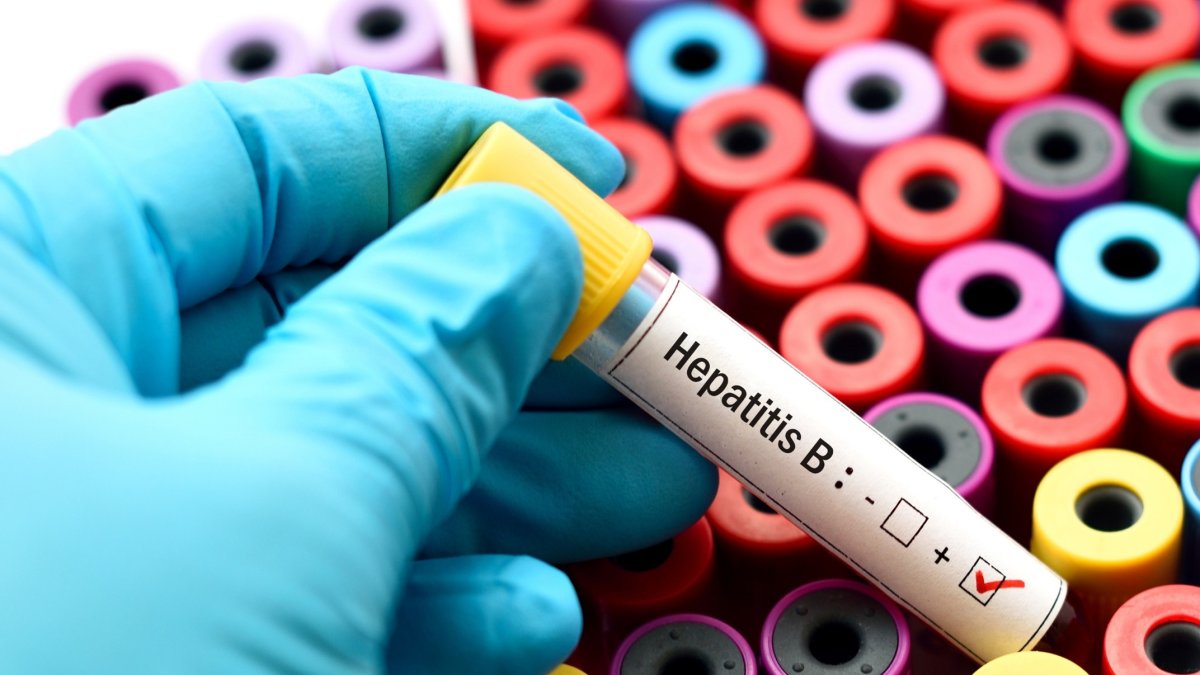 hepatitis-viral-causaria-mas-muertes-que-malaria,-tuberculosis-y-sida-combinados-para-2040
